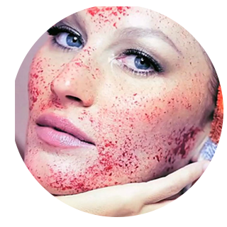 Intinerirea faciala cu plasma imbogățită cu trombocite